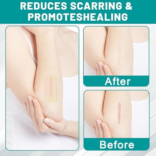 Hydrocolloid Roll, Hydrocolloid Bandages Roll for Wound Care, Medical Grade, Cut-to-Size, Self-Adhesive, Flexible & Waterproof, First Aid Kit Essential (2in x 6ft, 0.3mm Thickness) — view 5