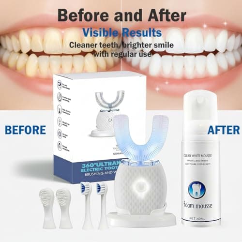 360° Ultrasonic U-Shaped Electric Toothbrush – Hands-Free Auto Cleaning with Foam Mousse, 4 Brush Heads, LED Light & Charging Base for Adults (White) — view 2