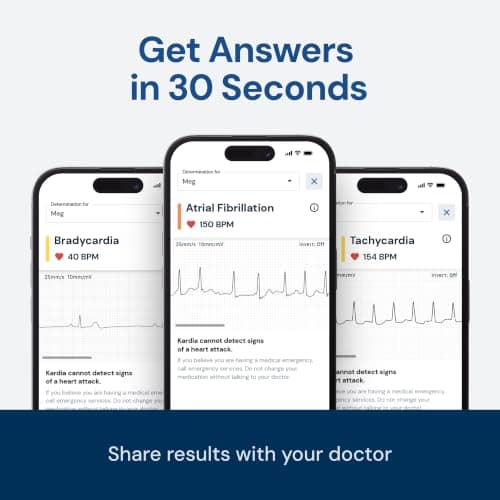 KardiaMobile 1-Lead EKG Monitor, Medical-Grade FDA-Cleared Personal Heart Monitor, Detects Normal, AFib & Arrhythmias, 30 Second Results, Works with Most Smartphones, HSA&FSA Eligible — view 2