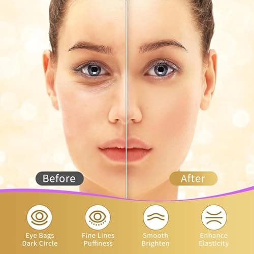 Under Eye Patches, 40 Pairs Eye Mask for Dark Circles, Puffy Eyes, Undereye Bags,Wrinkles,Eye Mask Patches with 24K Gold, Hyaluronic Acid,Rose & Aloe Vera, Eye Treatment Skin Care for Men & Women Gift — view 3