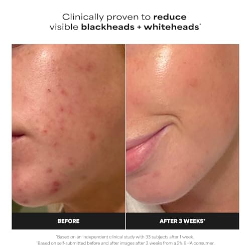 Paula's Choice SKIN PERFECTING 2% BHA Liquid Salicylic Acid Exfoliant, Daily Facial Exfoliator for Enlarged Pores, Wrinkles & Fine Lines, Fragrance-Free, Full Size - 118 ml — view 2