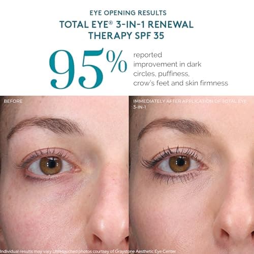 Colorescience Total Eye 3-in-1 Renewal Therapy, 0.23 Fl Oz, Medium — view 6