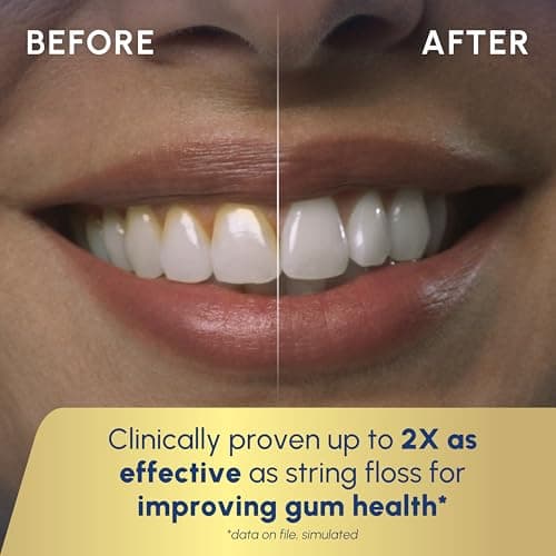 Waterpik Cordless Gem Water Flosser 5100 for Travel and Home, Rechargeable, Portable, Waterproof for Shower, Daily Gum Care, Cleaning Teeth, Braces, Implants, 3 Flossing Tips, ADA Accepted White WF-27 — view 4