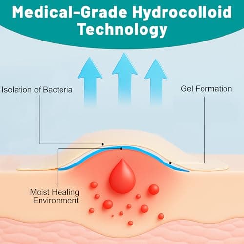 Hydrocolloid Roll, Hydrocolloid Bandages Roll for Wound Care, Medical Grade, Cut-to-Size, Self-Adhesive, Flexible & Waterproof, First Aid Kit Essential (2in x 6ft, 0.3mm Thickness) — view 3