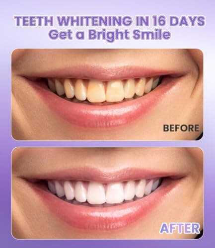 Purple Teeth Whitening Strips, No Hydrogen Peroxide (32 Strips) — view 3