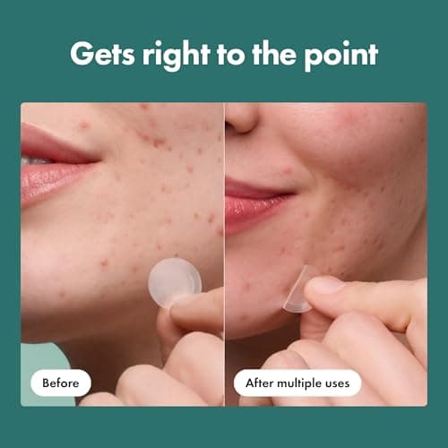 Mighty Patch Hero Cosmetics Micropoint Acne Pimple Patches, 8 Ct — view 5