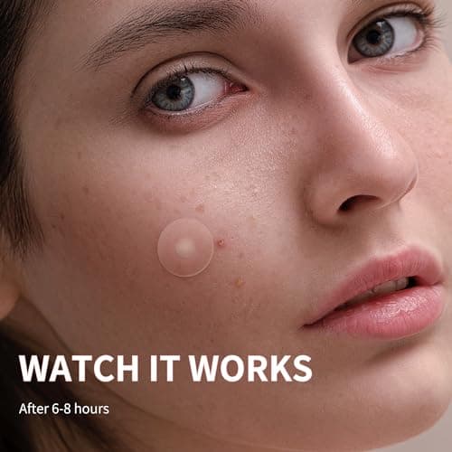 Daolyo Large Acne Pimple Patches for Face, 6 Sizes 142 Counts Big Hydrocolloid Bandages for Body, Forehead, Chin, Nose, Neck & Chest(Round, Oval, Moon, Square) — view 5