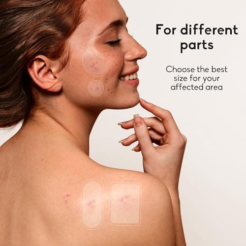 Daolyo Large Acne Pimple Patches for Face, 6 Sizes 142 Counts Big Hydrocolloid Bandages for Body, Forehead, Chin, Nose, Neck & Chest(Round, Oval, Moon, Square) — view 2