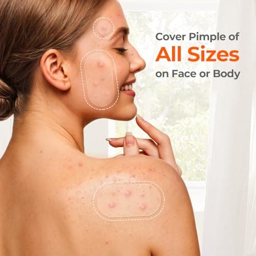 TKTK 443 Count Pimple Patches for Face, Hydrocolloid Acne Patch Bulk, Acne Stickers for Covering Cheeks, Forehead, Chin Blemishes Zit Breakouts for All Skin Types (Dots, Strip, Contoured 5 Sizes) — view 7