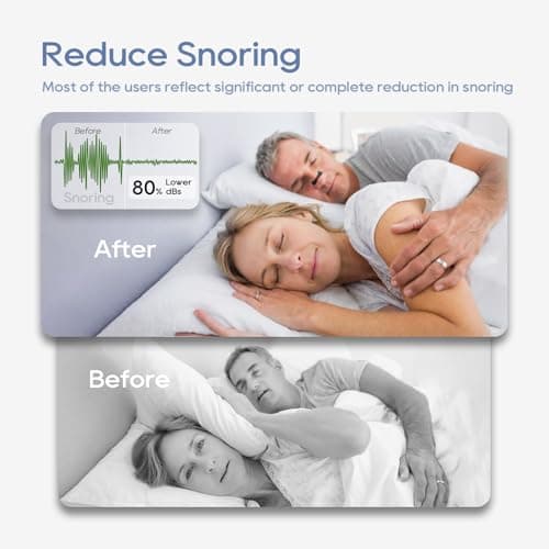 30 Pairs Anti-Snoring Sleep Magnetic Nasal Strips - Magnetic nasal strip Innovative Design Anti-Snoring Equipment Black — view 3