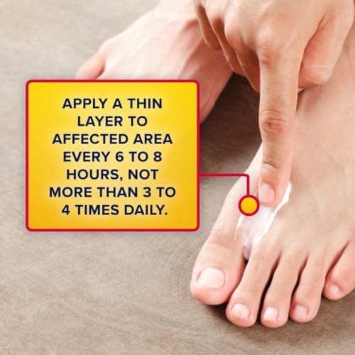 Aspercreme Lidocaine Pain Relief Liquid with No-Mess Roll-On Applicator, Max-Strength 4% Lidocaine Numbs Away Nerve Pain, Moisturizing Aloe Hydrates Dry Skin, 2.5 FL oz — view 8