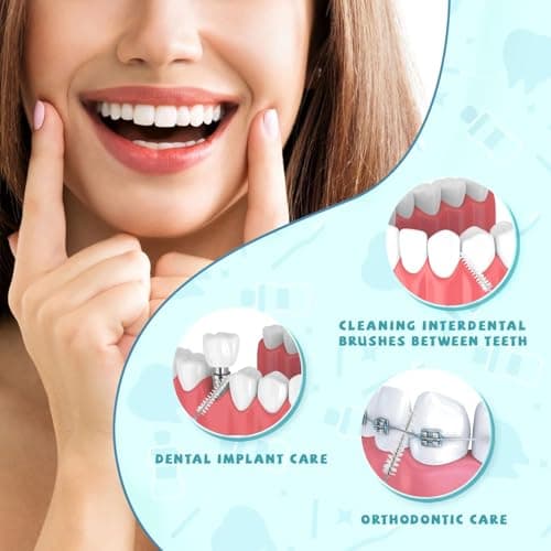 100PCS Interdental Brushes Between Teeth for Braces, Flossers Brush Cleaner, Orthodontic Flossers for Braces Cleaning Kit, Dental Teeth Cleaning Tools (10 Colors, Multiple Sizes