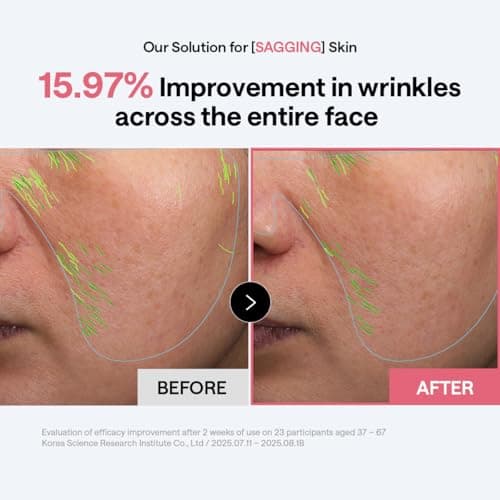 MEDIHEAL Collagen Firming Toner Pad – Korean Skincare, 98% Vegan Collagen with Retinol & 7 Peptides, Firming, Plumping & Wrinkle Care, Micro-Hole Fabric, 100 Pads — view 3