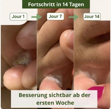 Veloma Antifungal Soap (5PCS) — view 4