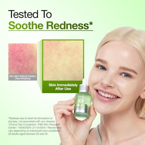 Anua Azelaic Acid 10 Hyaluron Redness Soothing Serum, Facial Serum for Blemish-Prone & Oily-Prone Skin, Lightweight & Hydrating Blemish Care, Hyaluronic Acid, Korean Skincare, 1.01 fl oz. — view 5