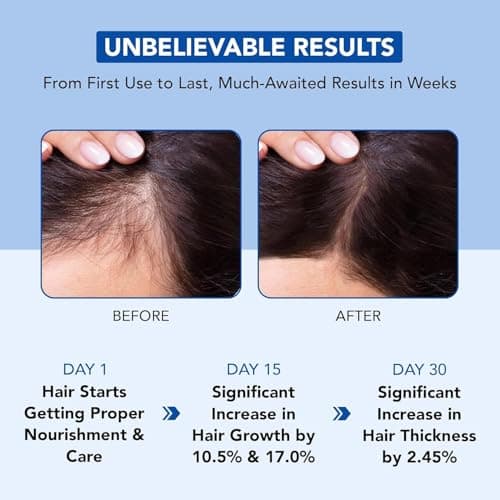 Botanic Hearth Rosemary Oil for Hair Growth | Strengthening Biotin, Jojoba, Castor Hair Growth Oil for frizzy hair | Dry, Damaged Scalp Treatment | Color Safe | All Hair Types | 6.7 Fl Oz — view 3