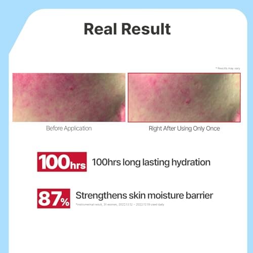 Illiyoon Ceramide Ato Lotion | Lightweight Moisturizer for Dry & Sensitive Skin, Barrier Repair for Face and Body, Mild for Babies, Vegan Certified, Korean Skincare, 2.29 fl.oz. — view 3