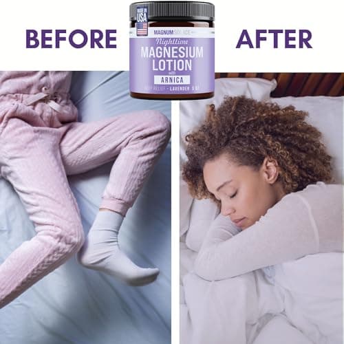 Nighttime Magnesium Lotion with Arnica – Highly Concentrated Magnesium for Muscles & Joints – Apply to Legs or Feet Before Bed – Skin-Friendly — view 6