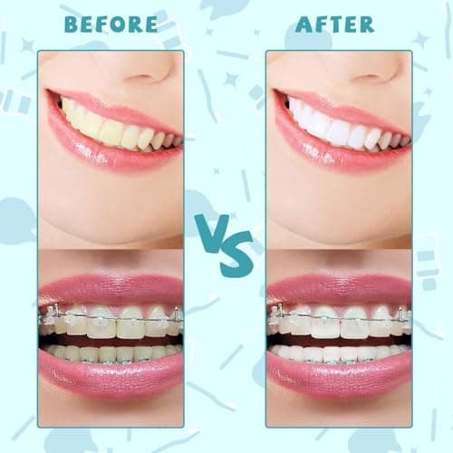 100PCS Interdental Brushes Between Teeth for Braces, Flossers Brush Cleaner, Orthodontic Flossers for Braces Cleaning Kit, Dental Teeth Cleaning Tools (10 Colors, Multiple Sizes — view 5
