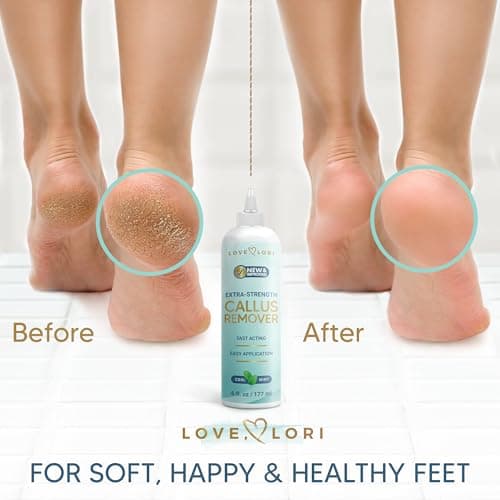 Love Lori Foot Callus Remover Gel Extra Strength Pedicure Tool for Feet 6oz — view 2