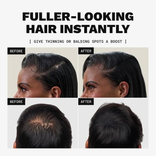 Toppik Hair Building Fibers, Black, 12g Fill In Fine or Thinning Hair, Instantly Thicker, Fuller Looking, 9 Shades for Men & Women, Keratin Protein Formula — view 2