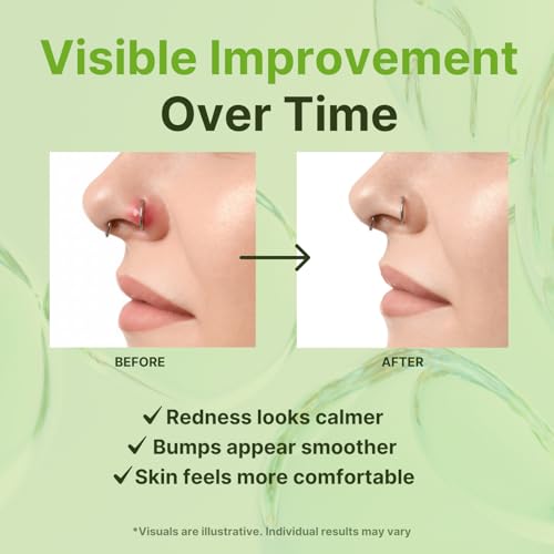 Tobcharm Piercing Bump Solution – Nose & Ear Piercing Bump Treatment for Irritation Bumps & Keloid Bumps, Piercing Aftercare Cleaner, Gentle Daily Piercing Care– 15ml — view 5