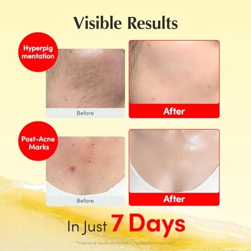 EQQUALBERRY Vitamin Illuminating Cream | Vitamin C & 5% Niacinamide+3% TXA | Dark Spots & Ceramide Barrier Strength Face Moisturizer | Glowy, Lightweight Hydration | Korean Skincare (1.69 fl.oz/50ml) — view 3