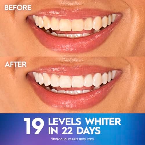 Crest Teeth Whitening Strips, Crest 3D Whitestrips Professional Effects, Enamel Safe Teeth Whitening Kit, 22 Treatments (44 Strips), Professional-Level Whitening, 19 Levels Whiter — view 3