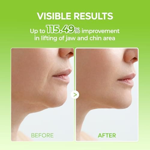 Dr.Melaxin CACTOX V-Lifting Mewing Band – Cactox + Caffeine + Collagen Double Chin Lifting Band for Sagging Jawline & Facial Puffiness | 115.49% Jaw & Chin Lifting Improvement | Korean V-Line Lifting — view 4