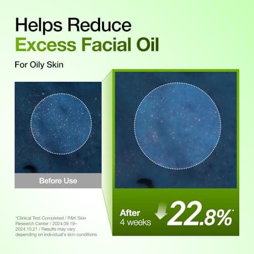 Anua Azelaic Acid 10 Hyaluron Redness Soothing Serum, Facial Serum for Blemish-Prone & Oily-Prone Skin, Lightweight & Hydrating Blemish Care, Hyaluronic Acid, Korean Skincare, 1.01 fl oz. — view 6