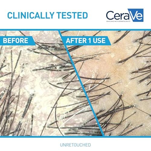 CeraVe 2-in-1 Anti-Dandruff Hydrating Shampoo and Conditioner, Gently Cleanse Scalp, Remove Flakes, & Reduce Itching while Hydrating the Hair. Suitable for all Hair Types, Even Colour-Treated. 355mL — view 2