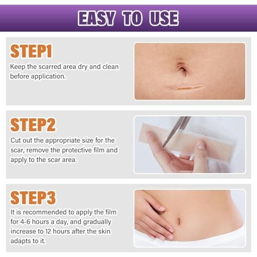 Silicone Scar Sheets, Medical Grade Silicone Scar Tape for Surgical, Hypertrophic, Keloid, C-Section, Burn, Old & New Scars, Reusable Professional Scars Removal Sheets (1.6"X 59" Roll-1.5M) — view 7