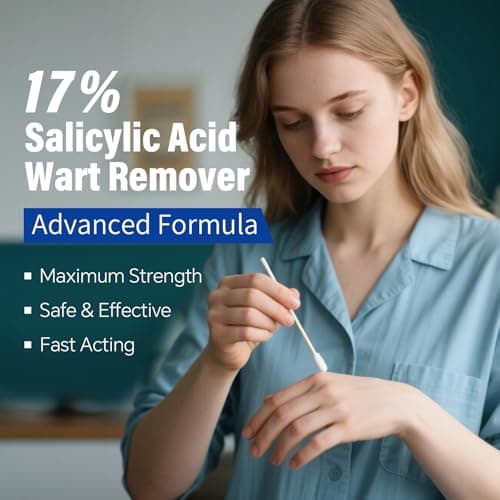 OSNOIA Extra Strength Wart Remover Liquid with 17% Salicylic Acid, Fast Acting Treatment for Plantar & Common Warts, Corn Remover for Feet and Toes (15ml, Warts Remover (1 P))