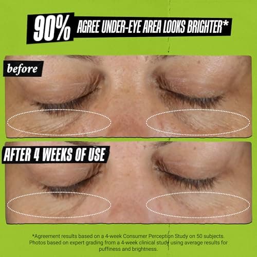 Kiehl's Avocado Eye Treatment, Nourishing and Hydrating Eye Cream, Avocado Oil and Caffeine to Energize and Invigorate Skin, Tired Eyes, 99% Naturally Derived Formula - 0.5 fl oz — view 4