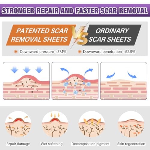 Silicone Scar Sheets, Medical Grade Silicone Scar Tape for Surgical, Hypertrophic, Keloid, C-Section, Burn, Old & New Scars, Reusable Professional Scars Removal Sheets (1.6"X 59" Roll-1.5M) — view 2