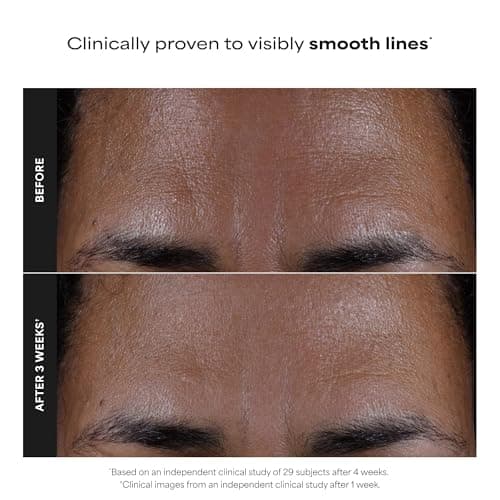 Paula's Choice SKIN PERFECTING 2% BHA Liquid Salicylic Acid Exfoliant, Daily Facial Exfoliator for Enlarged Pores, Wrinkles & Fine Lines, Fragrance-Free, Full Size - 118 ml — view 3