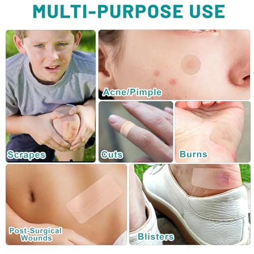 Hydrocolloid Roll, Hydrocolloid Bandages Roll for Wound Care, Medical Grade, Cut-to-Size, Self-Adhesive, Flexible & Waterproof, First Aid Kit Essential (2in x 6ft, 0.3mm Thickness) — view 2