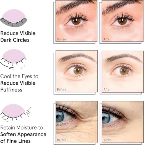 grace & stella Under Eye Mask - Birthday Gifts for Women, Gifts for Mom, Under Eye Patches to Reduce Dark Circles, Puffy Eyes, Eye Bags, Wrinkles, Travel Size Toiletries, Vegan (24 Pairs, Gold)