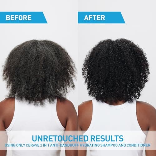 CeraVe 2-in-1 Anti-Dandruff Hydrating Shampoo and Conditioner, Gently Cleanse Scalp, Remove Flakes, & Reduce Itching while Hydrating the Hair. Suitable for all Hair Types, Even Colour-Treated. 355mL — view 5