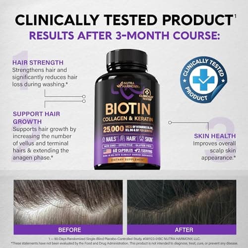 Biotin | Collagen | Hyaluronic Acid | Keratin - Hair Growth & Strength Support Vitamins - Skin & Nails Supplement - Clinically Tested for Men & Women - 25000mcg Vitamins B1, B2, B3, B6 & B7 - 60 Caps — view 3