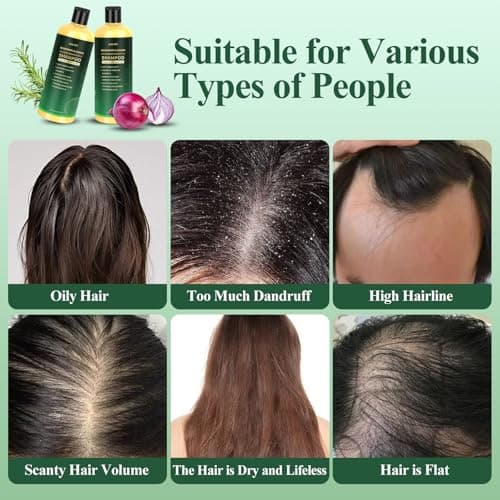 500ML Organic Rosemary & Onion Shampoo for Hair Growth Women & Men, Natural Hair Shampoo for Strengthening & Thickening with Hydrolyzed Keratin for Hair Loss, Oily Thinning Hair — view 3