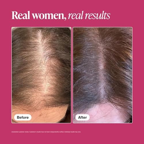 Viviscal Hair Growth Supplements For Women For Thicker, Fuller Hair, Nourishes Thinning & Loss, With Proprietary Collagen Complex, 60 Tablets, 1 Month Supply — view 4