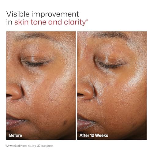 EltaMD UV Clear Face Sunscreen SPF, Oil-Free Sunscreen with Zinc Oxide, Dermatologist Recommended — view 7