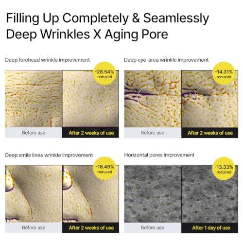 celimax The Vita A Retinal Shot Tightening Booster | 0.1% Retinal, 3% Matryxyl, High-Strength Retinoid for Anti-Aging, Pore Minimizer, Wrinkles & Fine Lines, Firmer Skin, 15ml, Korean Skin Care Gift — view 4