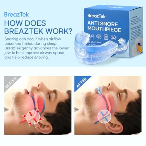 Anti Snoring Devices Mouth Guard: Adjustable Snoring Solution for Better Sleep - Snore Stopper for Men and Women — view 3