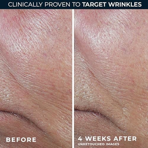RoC Derm Correxion Retinol Firming Serum Stick with Antioxidants to Visibly Tighten and Firm Wrinkles and Laugh Lines For Men and Women + Retinol Eye Cream Packette, 1.0 oz (Packaging May Vary) — view 4