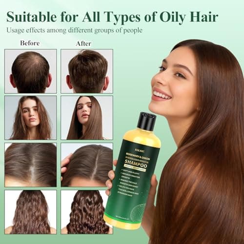 500ML Organic Rosemary & Onion Shampoo for Hair Growth Women & Men, Natural Hair Shampoo for Strengthening & Thickening with Hydrolyzed Keratin for Hair Loss, Oily Thinning Hair — view 2