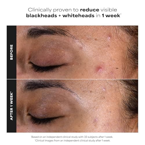 Paula's Choice SKIN PERFECTING 2% BHA Liquid Exfolitant, Salicylic Acid Exfoliant Toner Pads, Facial Exfoliator for Enlarged Pores, Wrinkles & Fine Lines, 10 ct — view 2