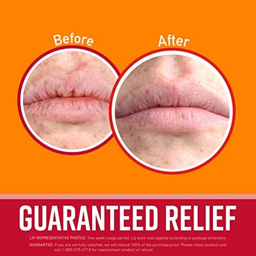 O'Keeffe's Lip Repair Chapstick Stick, Cherry & Vitamin E Oil Lip Balm for Dry Cracked Lips, Guaranteed Relief & All-Day Moisture in 1 Use, Lip Chap, 8 Moisturizing Ingredients, 1 Pack