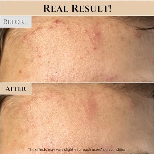 Beauty of Joseon Ground Rice and Honey Glow Mask Pore Sebum Care for Dry Sensitive Skin Korean Skin Care 150ml, 5.07 fl.oz — view 4